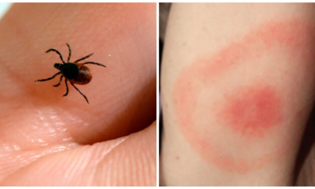 Canada funds $4 million for Lyme disease research