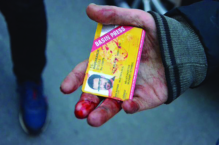 About 180 media outlets were shut down in Turkey. While one of those media was raided by police, the journalist was tortured due to the news coverage, and his yellow press card was blooded in 2015, in Turkey.